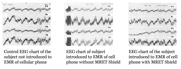 Charts measuring electrical activity of the brain when exposed to cell phone radiation