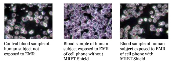 Image of live cell analysis.