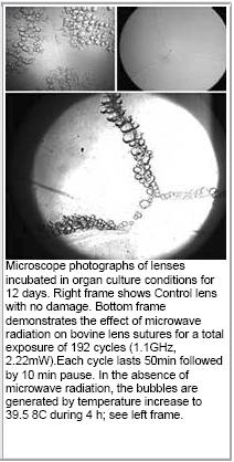 Image of effects of electromagnetic radiation on eye lenses.